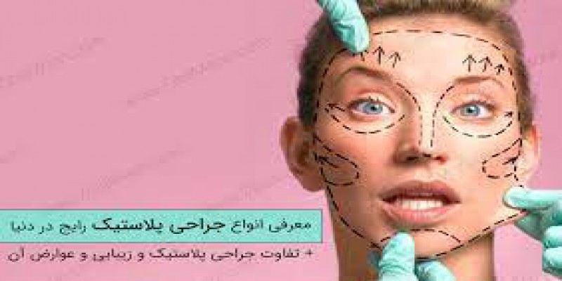 آیا بینی های گوشتی بعد از عمل پس از مدتی مجدد به شکل قبلی برمیگردد؟