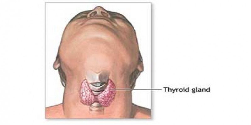 جراحی تیروئیدکتومی