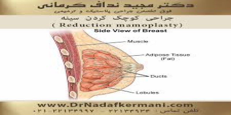 جراحی ترمیمی ماموپلاستی کاهشی