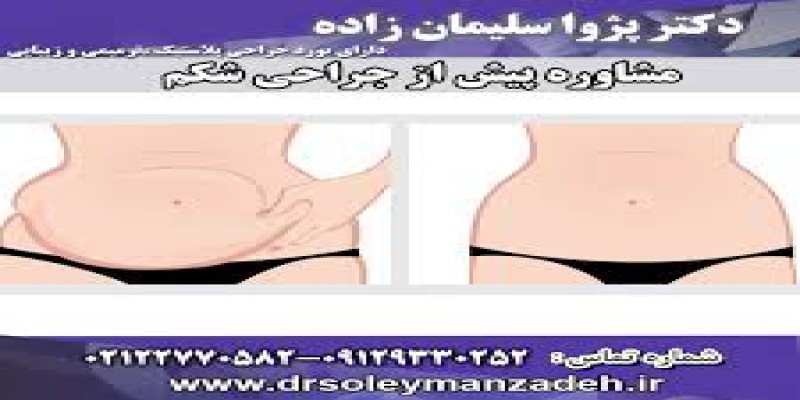 هزینه انجام لیفت شکم چقدر است؟