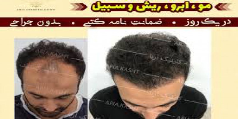 استفاده از اسپری محافظ مو