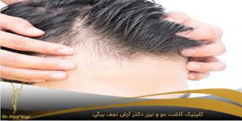 استفاده صحیح از شانه و برس